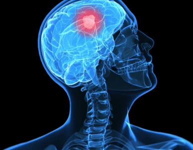 Chennai Neuroscience Foundation