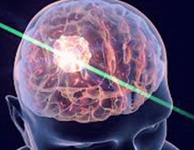 Chennai Neuroscience Foundation