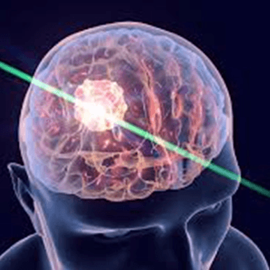 Chennai Neuroscience Foundation