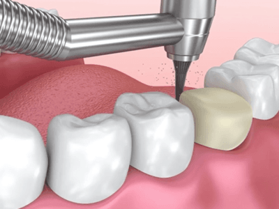 Edge Dental Care - Dental Clinic