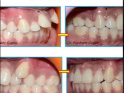 Braces & Smile Orthodontic and Dental Clinic