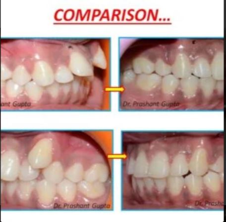 Braces & Smile Orthodontic and Dental Clinic