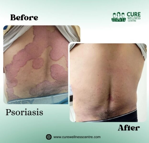 Cure Wellness Centre - Homeopathy Clinic